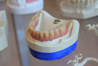 Finding a Denture Clinic Near Me Can Be Troubling but Here's the Best Way to Find ThemIllustration