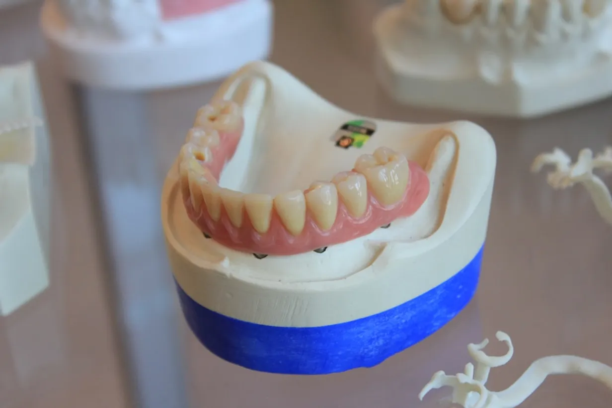 Finding a Denture Clinic Near Me Can Be Troubling but Here's the Best Way to Find ThemIllustration